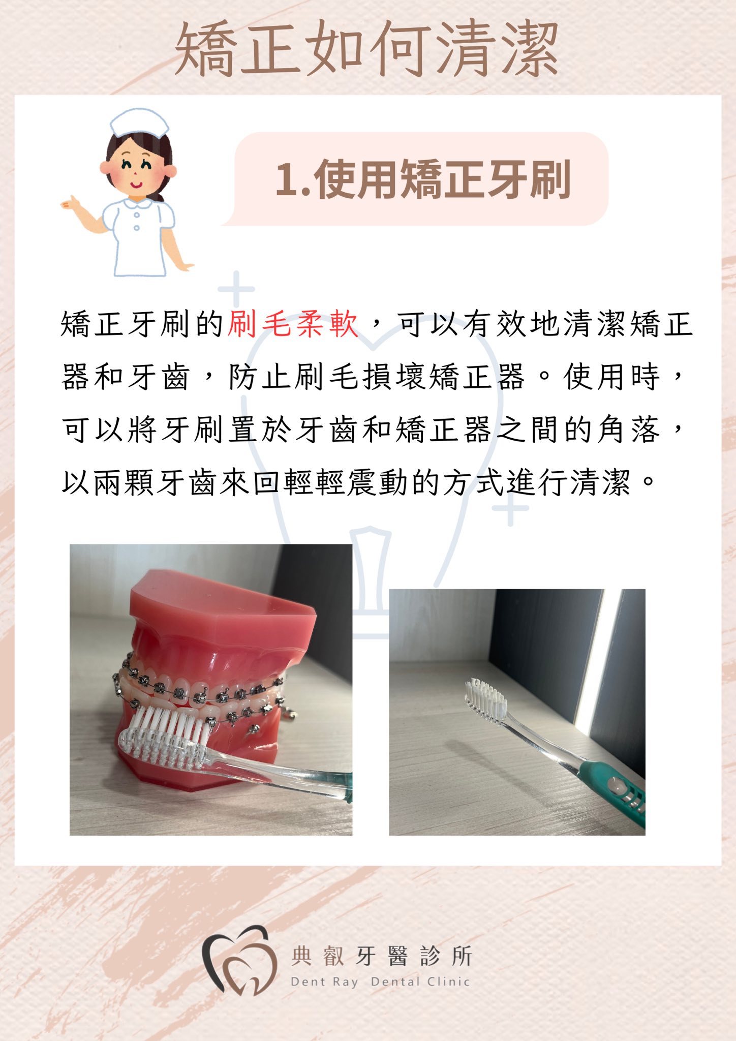 🦷 戴矯正器，刷牙要更仔細！