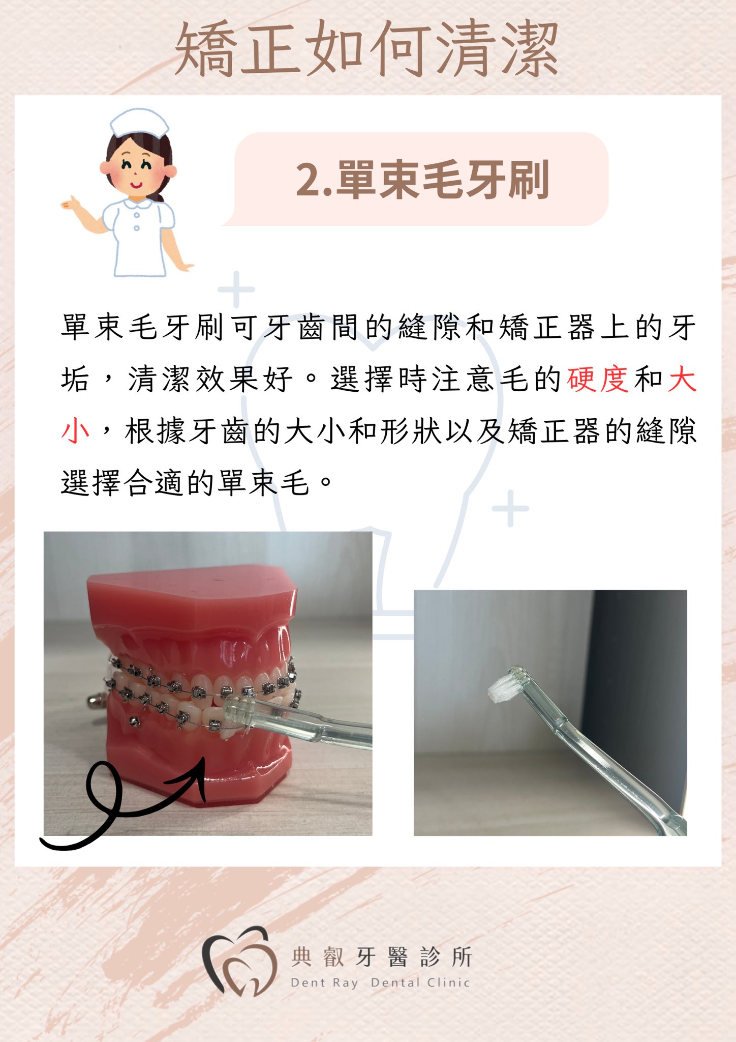 🦷 戴矯正器，刷牙要更仔細！