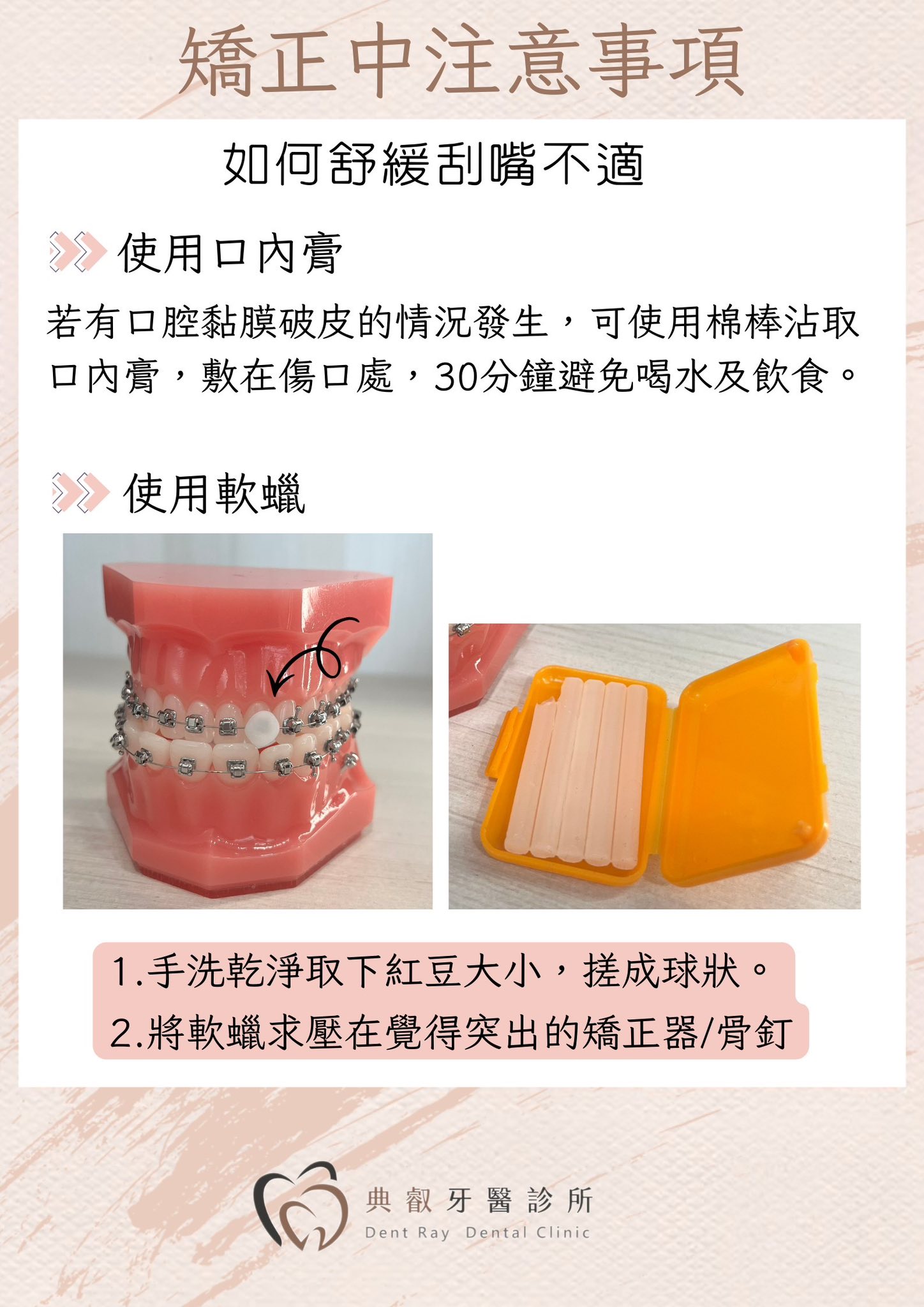 ✨ 矯正進行中，你也有這些小困擾嗎？